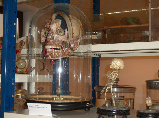 Wax Specimen found in the Museum of Anatomy and Embryology